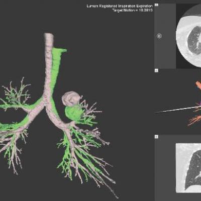 Pulmonary Perspectives® New Technology Enhances Electromagnetic ...