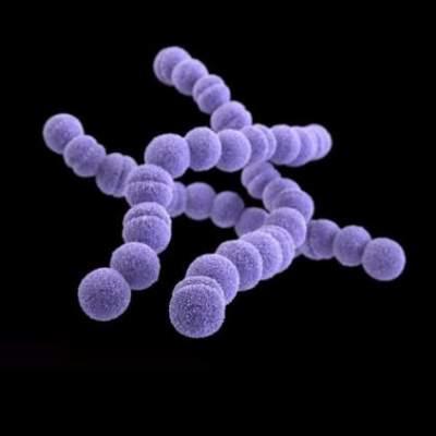 Invasive group A strep infection in the U.S. remains substantial ...