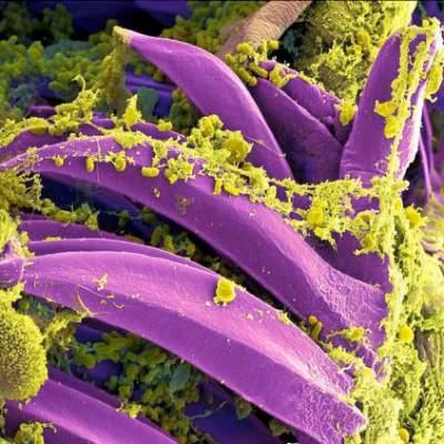 Unusual spike in U.S. plague cases in 2015 | MDedge Family Medicine