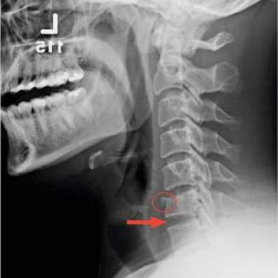 Ladder Becomes Stairway To Urgent Care Clinician Reviews