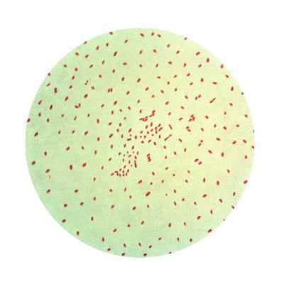 Underimmunization Incidences of underimmunization, vaccine refusal are clustered ...