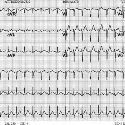 Clinical Conundrum 