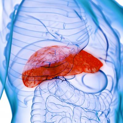 Prior decompensation in alcohol-associated hepatitis not an ‘absolute ...