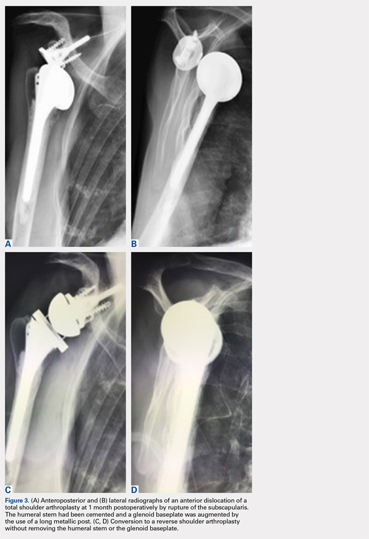 Anteroposterior and lateral radiographs