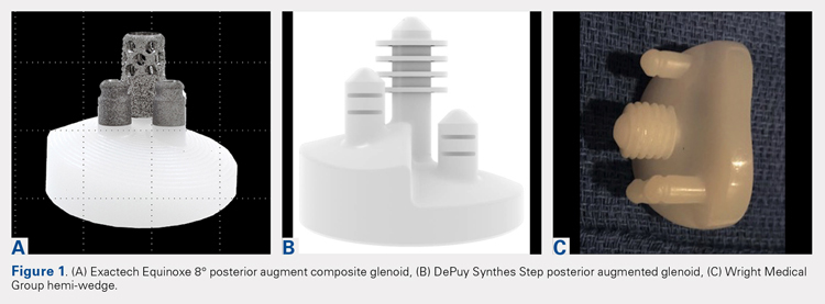 DePuy Synthes Step posterior augmented glenoid